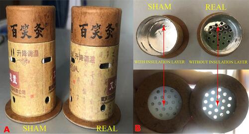 Figure 2 The exterior view (A) and the interior view (B) of moxibustion devices.