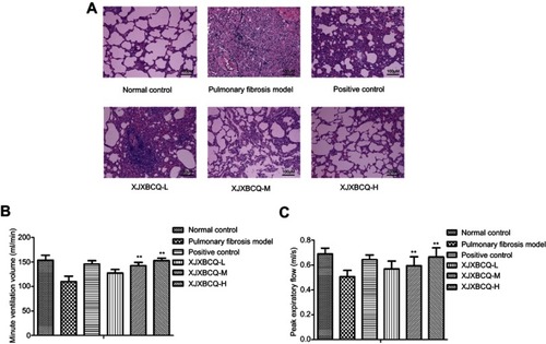 Figure 2 Effect of XJXBCQ on PF in BLM-induced rat. (A) Representative images of lung pathologic abnormalities with H&E staining: the inflammatory cells and collagen deposition in rats with PF. Scale bar, 100 μm. The lungs of rats were performed from rats treated with saline; BLM (7 μg/g), positive control and BLM+XJXBCQ on the 28th day. (B and C) Effects of MV and PEF in rats with PF from different groups. The values are shown as mean±SEM of the three experiments. **P<0.01 versus the model group.