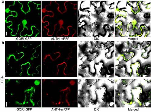 Figure 3. Subcellular localization of GORI and ANTH in tobacco epidermal cells. (a) Co-localization of GORI (p35S:GORI-GFP) and OsANTH3 (p35S:ANTH-mRFP) shows the signal in the PM, cytoplasm, and nucleus (b). Brefeldin A (BFA) treatment (10 µM) induces endosome-like structures containing GORI and ANTH signals in the cytoplasm (different focus image of top and bottom). Bars = 10 µm.