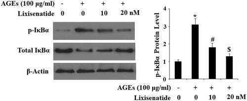 Figure 8. Lixisenatide ameliorates advanced glycation end products (AGEs)-induced phosphorylation and degradation of IκBα. Phosphorylated and total levels of IκBα were determined by western blot analysis (*, #, $, p < .01).
