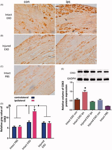 Figure 6. Immunohistochemical and Western blot analysis of CD63 in DRGs after exosome suspension injection. Immunohistochemical images showing the contralateral and ipsilateral sides of the DRG on day 5 (A) before (intact EXO) and (B) after the ipsilateral sciatic nerve was transectioned prior to exosome injection (injured EXO); and (C) the DRG of the PBS injection control group (intact PBS) on day 5 after exosome injection to the right gastrocnemius muscle. (D) Semi-quantitative immunohistochemical profile of the relative gray values of CD63 expression in the intact PBS, intact EXO, and injured EXO groups. n = 6. (E) Western blot image showing the relative CD63 protein expression in the DRGs in the five groups: intact EXO contralateral (con) and ipsilateral (ips) groups; injured EXO con and ips groups; and the intact PBS control group. n = 6. The asterisk indicates comparison with the opposite side and other groups, p < 0.01.