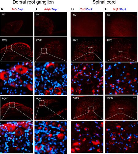 Figure 6 Tnf and Il-1β mRNAs are expressed in DRG and spinal dorsal horn neurons of OVX and aged mice. (A–D) In situ hybridization results show that both Tnf and Il-1β were located in cytoplasm of DRG neurons (A and B) and spinal dorsal horn neurons (C and D) of OVX and aged mice. The red dots are signals and blue ones Dapi. Scale bar: 100 μm.