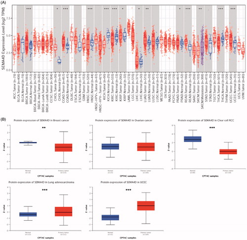 Figure 1. Sema4D expression levels in various human tumours. (A) Sema4D mRNA expression in human tumours and corresponding normal tissues based on TCGA database analysed by TIMER. (B) Sema4D protein expression levels in different types of human cancers compared with normal tissues based on the CPTAC database in UALCAN.