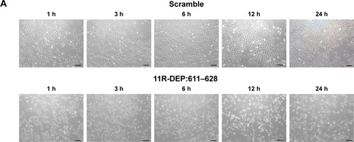 Figure 4 The 11R-DEP:611–628 peptide induces apoptosis of A549 cells. A549 cells were treated with 5 μM 11R-DEP:611–628 peptide or scramble peptide for the indicated time. (A) Cell morphological changes of A549 cells after peptide treatment were monitored with contrast phase microscope. The pictures showed that cells appeared abnormal and began to shrink within 1 h after treatment with the 11R-DEP:611–628 peptide, and the changes were time dependent. Scale bar 100 μm. (B, C) Compared with that of the scramble group, apoptosis levels of cells treated with the 11R-DEP:611–628 peptide were increased significantly. Representative data of flow cytometry are shown in panel B, and results of quantitative analysis of flow cytometry are shown in panel C. The difference between the 11R-DEP:611–628 and scramble groups was compared by paired t-test. Value of P=0.0006. (D) Western blot results showed that caspase 3 levels were decreased in cells treated with the 11R-DEP:611–628 peptide; meanwhile, cleaved caspase 3 levels were increased, indicating enhanced apoptosis.