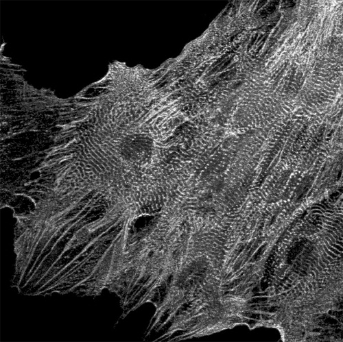 Figure 1 HESC‐derived cardiomyocytes stained with anti‐α‐actinin antibody. The cardiomyocytes were obtained by coculturing HESCs with an endoderm‐like cell line (END‐2).