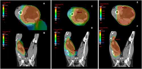 Figure 1. Axial and coronal CT dosimetry demonstrating a PBT (A,B), IMRT/VMAT (C,D), and 3D-CRT (E,F) treatment plan.