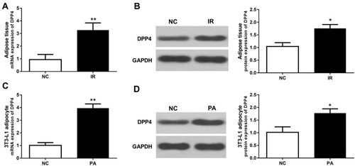 Figure 1 Expression of DPP4 in adipose tissues and adipocytes under IR conditions. (A, B) The mRNA and protein expression levels of DPP4 were increased in the IR rats compared with the normal controls. (C, D) The mRNA and protein expression levels of DPP4 were increased in the IR cells compared with the controls. *P < 0.05, **P < 0.01.