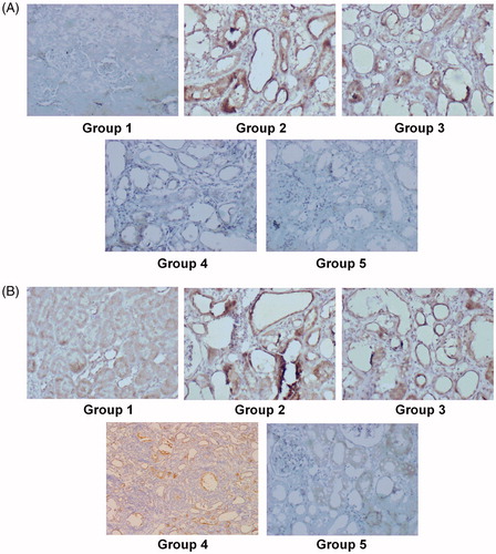 Figure 4. Immunohistochemical staining revealing the expression and location of KIM-1(A) and P-JNK (B) (100×).