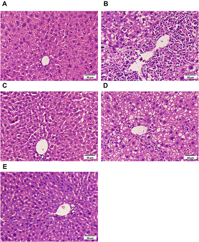 Figure 1 The H&E staining of representative liver tissues in experimental mice. (HE×200). (A) Normal mouse liver. (B) CCl4 treated mouse liver. (C) Bifendate treated mouse liver (200 mg/kg). (D) Hyp-L (low dose, 50 mg/kg). (E) Hyp-H (high dose, 100 mg/kg).