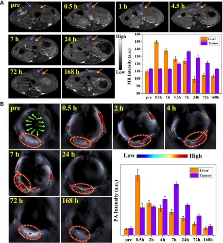 Figure 5 In vivo MR and PA imaging studies of MPGds. (A) T1-weighted MR axial images and the corresponding data analysis of MR measurements of tumor-bearing mice before (pre) and at various time points (0.5 hr, 1 hr, 4.5 hrs, 7 hrs, 24 hrs, 72 hrs and 168 hrs) after injection of MPGds using 3.0 T clinical MRI equipment. The purple arrows point the tumor sites and the orange arrows point the liver. (B) PA images and the corresponding PA signal intensities in the tumor region collected by the MOST imaging system before (pre) and at various time points (0.5 hr, 2 hrs, 4 hrs, 7 hrs, 24 hrs, 72 hrs, and 168 hrs) after injection of MPGds. The green arrows point the liver and the yellow circles point the orthotopic tumor sites. Error bars mean standard deviations (n = 4).