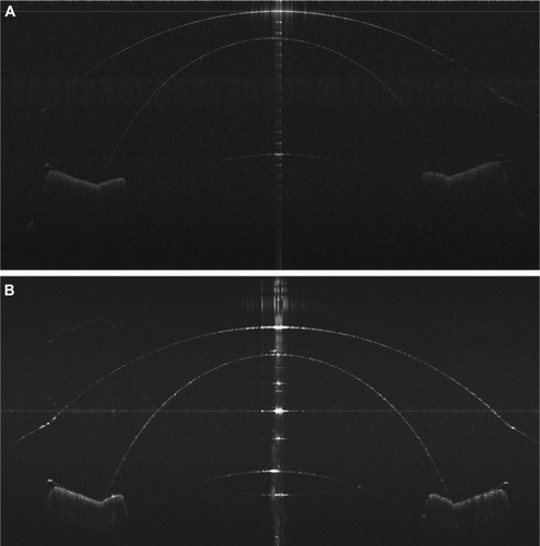 Figure 8 Model eye images.