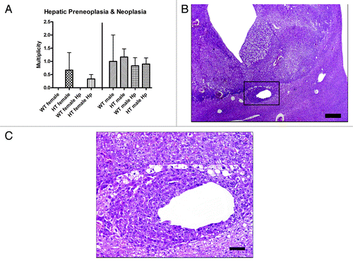 Figure 2. (A) Multiplicity of hepatic preneoplasia and neoplasia in the different groups of mice. (B) Hepatocellular carcinoma in a hepatitis C virus transgenic male mouse infected with H. pylori (HT male Hp). The tumor is poorly demarcated from the normal liver tissue and there is vacuolation of neoplastic cells and dilation of sinusoids. (C) Higher magnification (box in B) view of the junction between the poorly demarcated neoplasm and adjacent normal parenchyma. Neoplastic cells have cytoplasm with a deeper basophilic staining intensity and are often vacuolated. A focus of neoplastic cells also surrounds a distended hepatic sinusoid. (B) bar size 500 µm. (C) bar size 100 µm.