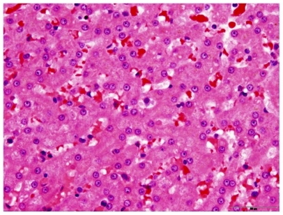 Figure 2 Histopathology of the liver in a treated dog, showing no evidence of change compared with normal liver.Figure 3 Histopathology of the spleen in a treated dog, showing no evidence of change compared with normal spleen. This picture also shows occasional macrophages that contain golden-brown pigment granules consistent with hemosiderin.Figure 4 Tissue concentrations of CTI 52010. Accumulation of CTI 52010 was determined post mortem in the liver, kidney, and spleen of all three dogs using highpressure liquid chromatography following tissue homogenization and extraction.Display full sizeDisplay full sizeDisplay full size