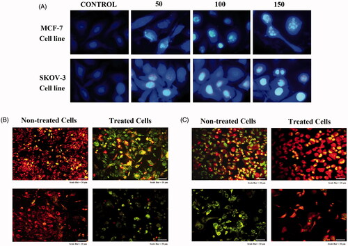Figure 11. Fluorescence microscopy images of MCF-7 cell line (upper lane) and SKOV-3 cell line (lower lane) treated with modified nanochrysin loaded in PLGA-PVA. (A) Nuclear aspects using DAPI stain. (B) Mitochondrial membrane potential assay. (C) Morphological changes of acridine orange-ethidium bromide dual staining.
