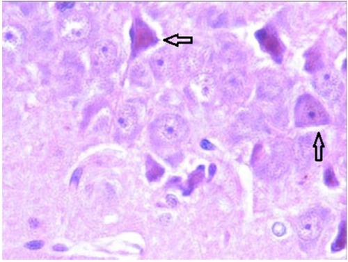 Figure 2 Photomicrograph showing pyramidal neurons (arrows) in the CA2 hippocampal region.