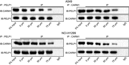 Figure 4 Higher dosage of Gallic acid resulted in weaker binding of CARM1 to PELP1. The binding of CARM1 to PELP1 was detected in the A549 and NCI-H1299 cells treated with Gallic acid at different dosages by Co-IP experiment.