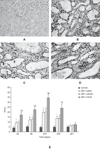 Figure 4. Effects of rrALR on renal tubular cellular proliferation in rats. PCNA-positive tubular cells were seldom observed in normal rats (A). The number of PCNA-positive tubular cells increased after the administration of GM in the GM+saline (B) and GM+vehicle (C) groups. Intraperitoneal injection of rrALR enhanced the number of PCNA-positive tubular cells significantly (D) as compared with the GM+vehicle group (SABC, ×400). There was no significant difference in PI between the GM+saline and GM+vehicle rats (E). Data are shown as the mean ± SEM. *p < 0.05 vs. the normal group; #p < 0.05 vs. the GM+vehicle group.