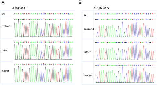 Figure 3 Results of Sanger sequencing. (A) c.790C>T sequencing plot; (B) c.2287G>A sequencing plot. The site indicated by the arrow is the mutation site; Top panel: the child; Middle panel: father; Bottom panel: mother.