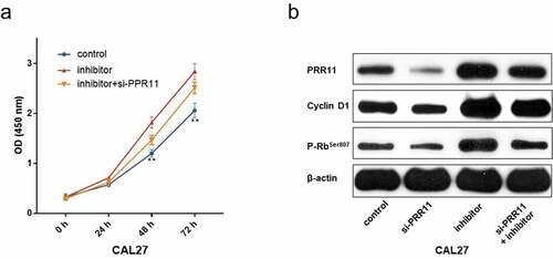 Figure 6. PRR11 knockdown attenuates the repression effects of miR-26b-5p on CAL27cell proliferation. (a) the viability of each group of cells was detected by CCK-8 assay. (b) western blot analysis of the impact of si-PRR11 on PRR11, cCyclinD1 and p-RbSer807 expression. data are presented as the mean ± SD