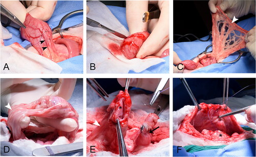 Figure 3. Group B was a staged procedure to assess if a staged technique improved viability of the bladder vesicle. During the first surgery (A-C) branches of the caudal vesicular artery (black arrowheads) were ligated (A) to stress the bladder and encourage neovascularization. The serosal layer of the bladder was then excoriated (B) and omentalized (white arrowhead). Dogs recovered over 2 weeks prior to the second surgery. During the second surgery (D-F) the bladder vesicle was created as in Group A. (D) Omental adhesions were present (white arrowhead) circumferentially over the bladder. (E) The omentalized (white arrowhead) body of the bladder (asterisk) was transected from the trigone (black arrow). Each was oversewn again preserving the trigone with intact ureters. (F) The omentalized bladder vesicle (asterisk) was tacked to the body wall.