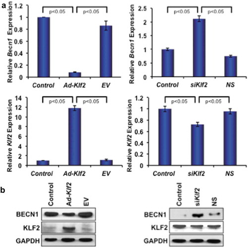 Figure 6. KLF2 inversely regulates Beclin1 gene and protein expression. (a) Quantitative PCR analysis of Becn1 gene expression (left, upper panel) is shown graphically after over-expression of Klf2 (left lower panel) in RAW264.7 cells; and similarly expression of Becn1 gene (right, upper panel) is presented after knockdown of KLF2 (right, lower panel) in RAW264.7 cells. (b) BECN1 protein expression is depicted after overexpressing KLF2 (lower, left panel) and knocking off KLF2 (lower, right panel) in RAW264.7 cells. The levels of GAPDH were depicted as internal controls.