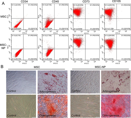 Figure 3 Fundamental Characteristics of Nanoparticle (NP)-Labeled Placental Mesenchymal Stem Cells (PL-MSCs). (A) Immunophenotyping of MSCs labeled with NPs compared to unlabeled MSCs. (B) Differentiation potential of MSCs into adipogenic and osteogenic lineages under various culture conditions.