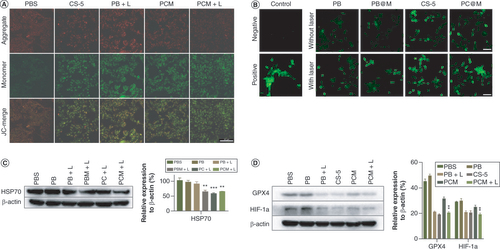 Figure 5. Ferroptosis mechanism in vitro. (A) The mitochondrial membrane potential (MMP) of HCT116 cells after incubation with PBS, CS-5, PBM+L, PCM and PCM+L using JC-1 assay; red represents normal MMP and green represents decreased MMP (scale bar = 50 μm). (B) Fluorescence images of ROS production after treatment with PB, PBM, CS-5 or PCM in HCT116 cells (scale bar = 20 μm). (C) The expression level and quantitative analysis of HSP70 after treatment with PBS, PB, PB+L, PBM+L, PC+L and PCM+L (**p < 0.01; ***p < 0.001). (D) The expression level and quantitative analysis of GPX4 and HIF-1a after the treatment with PBS, PB+L, PBM+L, CS-5, PCM and PCM+L (**p < 0.01).CS-5: Bufotalin; L: Laser; PB: Prussian blue; PBM: PB@M; PBS: Phosphate-buffered saline; PC: Bufotalin–Prussian blue nanoparticle; PCM: Bufotalin–Prussian blue biomimetic nanoparticle; ROS: Reactive oxygen species.