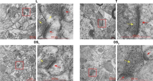 Figure 7 The ultrastructure of hippocampal neurons as revealed by TEM.