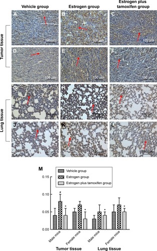 Figure 6 Protein immunohistochemical results of ERα in mice tumor tissue and lung tissue; 400× magnification.