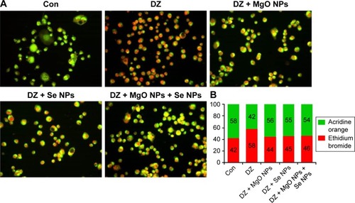 Figure 7 (A) Representative fluorescence microscopic images of PaTu cell line double stained with AO and EB after 24 hours of exposure to articles MgO NPs, Se NPs, and their combination in the presence of DZ. (B) Quantification of viable and dead cells according to percentage of fluorescence intensity of AO/EB.Notes: (A) Viable cells appear uniformly green; early apoptotic cells show characteristic loss of membrane integrity and chromatin condensation, stain bright green to yellow; late apoptotic cells incorporate EB and therefore stain yellow orange and show condensed and often fragmented nuclei; necrotic cells are orange red in appearance. Images of the fields were acquired at a magnification of ×20. (B) AO is a vital dye and stains both live and dead cells, but EB stains only cells that have lost membrane integrity. So, an increase in the percentage of EB-stained cells indicates an increase in cell damage (apoptosis and necrosis).Abbreviations: Con, control; DZ, diazinon; MgO NPs, magnesium oxide nanoparticles; Se NPs, selenium nanoparticles; AO, acridine orange; EB, ethidium bromide; NPs, nanoparticles.