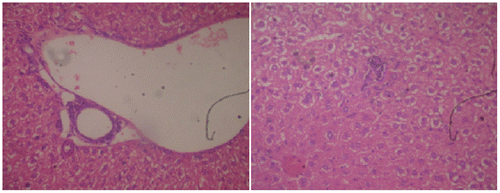 Figure 3a. Section of mouse liver treated with 120 mg/kg of G. lucidium total extract showing a mild active hepatitis with no inflammatory at central vein and slight portal inflammation. (Hematoxylin and eosin-stained paraffin section; H&E 200).