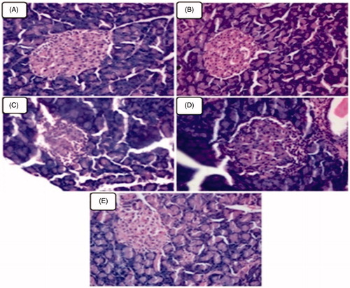 Figure 3. (A–E) Represents the microphotographs of pancreatic tissues of normal control and experimental rats in each group (haematoxylin and eosin staining, 40×). (A and B) Normal control and normal control + geraniol (200 mg/kg body weight) treated rats showed normal appearing pancreatic exocrine glands and ducts with Islet of Langerhans. (C) Diabetic rats showing fatty infiltration and shrinkage of islet cells. (D and E) Pancreatic tissues from diabetic + geraniol (200 mg/kg b.w.) and diabetic + glyclazide (5 mg/kg b.w.) treated rats shows normal appearing pancreatic acini with absence of dilation and prominent hyperplastic of islets.