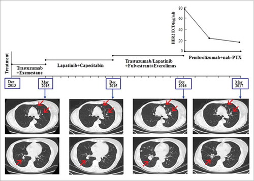 Figure 1. In case 1, CT images showed a continuously increase of the lung metastases during multi-anti-HER2 targeted therapy and a remarkable decrease after treatment of pembrolizumab plus albumin-bound paclitaxel with the reduction of serum HER2 ECD levels.