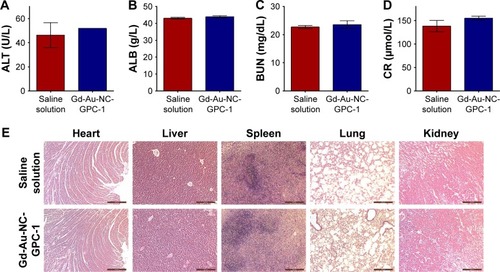 Figure 9 Acute toxicology evaluation of Gd-Au-NC-GPC-1 in vivo. Healthy nude mice were intravenously injected with 200 μL saline solution or Gd-Au-NC-GPC-1 (Gd: 50 μM/kg) and then were euthanized 24 hours later (n=3). (A–D) Results of serum biochemistry analysis. (E) H&E stained images of mice visceral organs. Scale bar: 200 μm.Abbreviations: ALB, albumin; ALT, alanine aminotransferase; BUN, blood urea nitrogen; CR, creatinine; Gd-Au-NC-GPC-1, Gd–Au NCs conjugated with GPC-1 antibody; GPC-1, Glypican-1; H&E, hematoxylin and eosin; NCs, nanoclusters.