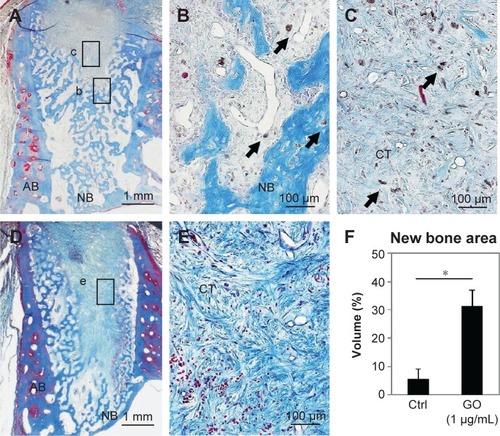 Figure 8 Histological findings in extraction socket at 2 weeks.Notes: (A) Specimen receiving 1 µg/mL GO scaffold. (B and C) Higher magnification of the framed area (b, c) in (A). Residual GO (arrows) were observed in newly formed bone and connective tissue. (D) Specimen receiving control material. (E) Higher magnification of the framed area (e) in (D). MT staining. (F) Histomorphometric measurements of newly formed area. *P<0.05. Original magnification (A, D) 3×, (B, C, E) 50×.Abbreviations: AB, alveolar bone; NB, new bone; CT, connective tissue; GO, graphene oxide; MT, Masson’s trichrome; Crtl, control.