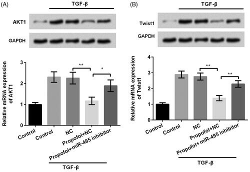 Figure 4. Propofol decreases AKT1 and Twist1 expression through regulating miR-495. JEG-3 cells were transfected with miR-495 inhibitor and the corresponding negative control and then were treated with propofol (1 μM). Then, the mRNA and protein expression of (A) AKT1 and (B) Twist1 was evaluated using qRT-PCR and western blot analysis. *p < .05, **p < .01.