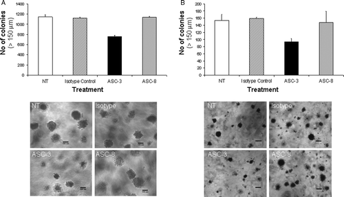 Figure 7.  Effects of β4-specific antibodies on anchorage-independent growth. (A) Colon (SW620) or (B) breast (MDA-MB-231) cancer cells were grown in 0.3% soft agar containing ASC-3 or ASC-8 (10 µg/ml). Plates were supplemented twice weekly with antibody-containing medium. Anchorage-independent growth was scored by manual counting of colonies >150 µm 21 to 27 days after plating. Error bars represent variation between duplicates. Pictures of colonies are representative examples. Size bar represents 199 µm.