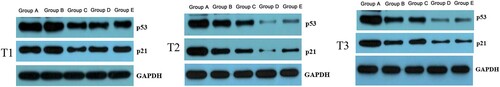 Figure 4. Relative expression level of p53 and p21 at different time. Note: T1: Protein expression of p53 and p21 in different groups before surgery; T2: Protein expression of p53 and p21 in different groups 6 h after surgery; T3: Protein expression of p53 and p21 in different groups after surgery; Group A: No treatment was taken after the rabbits were anaesthesia; Group B:After the rabbits were anaesthesia, the left lateral lobe of the liver was surgically resected under open abdomen, and the blood volume was supplemented by infusion of sodium lactate Ringer's solution without transfusion; Group C:10% of rabbit whole blood was collected and stored one week before surgery. Then the left lateral lobe of liver was surgically removed, and the blood volume was supplemented by infusion of sodium lactate Ringer's solution without transfusion; Group D: 10% of rabbit whole blood was collected and stored one week before surgery. The left lateral lobe of liver was surgically removed, and the stored autologous whole blood was transfused back during the operation; Group E: 10% of rabbit whole blood was collected one week before surgery and made into suspended red blood cells for storage. One week later, the left lateral lobe of the liver was surgically removed and the stored autored blood cells were transfused back during the operation.