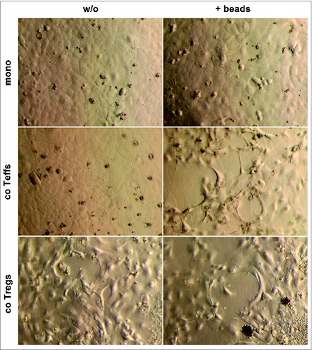 Figure 1. H6c7 cells acquire a spindle-shaped morphology in the presence of activated CD4+ T-effs and T-regs. Representative images (n = 7 experiments with T cells isolated from seven individual donors) showing cell morphology of H6c7 cells monocultured (mono) or directly co-cultured with T-effs (co T-effs) or T-regs (co T-regs) for 72 h, either in the absence (w/o) or presence of activation beads (+ beads). Magnification x 400.