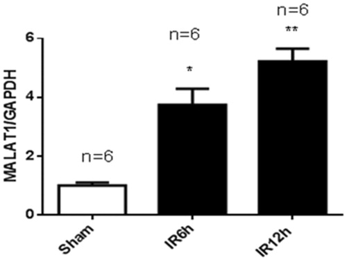 Figure 2. Renal ischemia/reperfusion injury increased the expression of MALAT1 in vivo. Kidneys were collected at 6 h and 12 h after sham (n = 6) or renal ischemia/reperfusion injury (IRI) (6 h, n = 6; 12 h, n = 6) in mice. The expression of MALAT1 was measured by RT-PCR, and the ratio of MALAT1/GAPDH was normalized to the sham group. *p < .05 vs the sham group; **p < .01 vs the sham group.