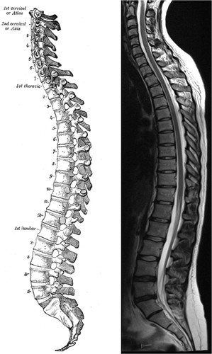 Figure 5. Sagittal view of the spine. A drawing from 20th US edition of Gray`s Anatomy of the Human Body (left). This edition was originally published in 1918 and is now in the public domain. For comparison is a MR image of the spine showing mild degenerative changes in the lower lumbar spine (right).