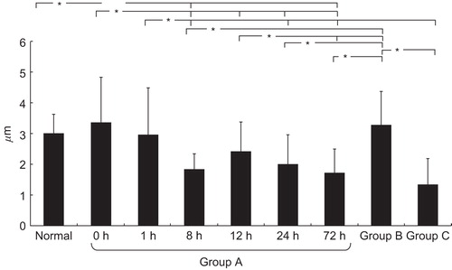 Figure 2. The results of measurement of the diameters of muscle cells in groups A, B, and C. In group A, the longer the ischaemic time, the more evident was muscle atrophy. In group B muscle atrophy was not pronounced. Group C showed severe atrophy. *p < 0.05.