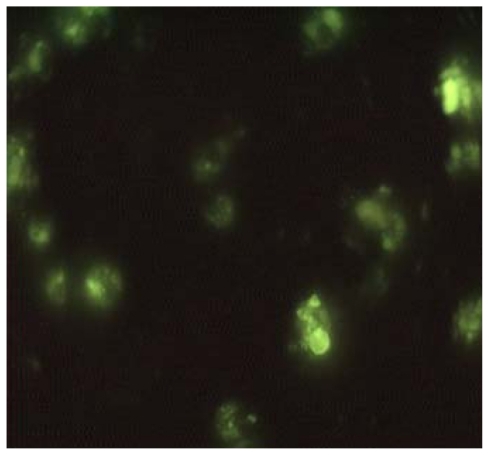 Figure 6 Andrographolide nanoparticles in macrophages under fluorescence microscope after 2 hours’ incubation.