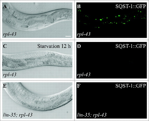 Figure 9. Accumulation of SQST-1 aggregates in the intestine in rpl-43 mutants. (A and B) SQST-1::GFP accumulates into a large number of aggregates in the intestine in rpl-43 mutant L4 larvae. (C-F) Accumulation of SQST-1 aggregates in rpl-43 mutant L4 larvae is suppressed by elevated autophagy activity induced by starvation (C and D) or by lin-35 inactivation (E and F). (A, C, and E) DIC images of the animals shown in (B, D, and F), respectively. Scale bar: 20 μm (A–F).