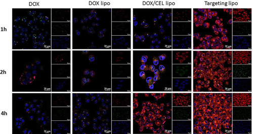 Figure 7 Mitochondrial targeting ability of different DOX formulations in MCF-ADR cells at different times. DOX was visualized as the red fluorescence, nucleuses labeled with DAPI were shown as the blue fluorescence and green fluorescence indicates Mitotracker Green labeled-mitochondria. Scale bars correspond to 20 μm in all images.