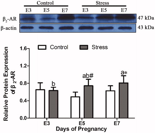 Figure 4. Effects of restraint stress on the relative protein expression of β2-AR in the uterus of pregnant mice. After restraint stress treatment, the expression of β2-AR protein in uterine tissue was increased, and the content of β2-AR protein was not affected by gestational age. The uppercase letters represent differences in the control group among E3, E5 and E7, and the lowercase letters represent differences in the stress group among E3, E5 and E7 (p < 0.05). *p < 0.05 and #p < 0.01 are used to denote significance compared with the corresponding control groups.