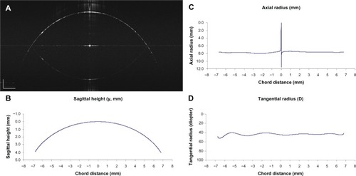 Figure 6 Analysis of detected surface of the spherical metal calibration ball.