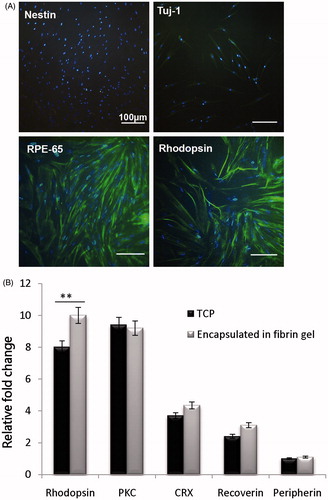 Figure 6. Immunocytochemical analysis for expression of as b-tubulin III, Rhodopsin, RPE65 and Nestin as markers of mature neurons in CJMSCs 14 days PT by Photoreceptor inducing signaling molecules compared to noninduced CJMSCs controls. Nuclei were co-stained with 4,6-diamidino-2-phenylindole to visualize nuclei (blue). Scale bar 100 (μM) (A). Gene expression profile of CJMSCs differentiated on scaffolds on day 14. The cells were maintained in induction medium for 14 days and analyzed for expression of photoreceptor genes. The column ratio of mRNA expression levels are the expression rate of genes compared with untreated cells. TBP and HPRT-1 are shown as a control for RNA sample quality. Rest software was used for gene expression analysis using real-time PCR data from the rotor-gene Q. Asterisks show significance expression rate *p ≤ .05 (B).