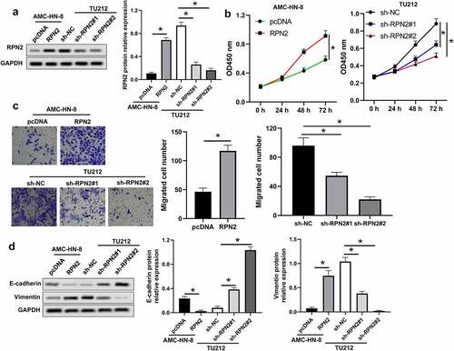 Figure 2. RPN2 facilitated the tumorigenesis of LSCC cells. (a) Western blot assay for RPN2 protein levels in LSCC cells after overexpressing or silencing RPN2. (b) The viabilities of AMC-HN-8 cells transfected with RPN2 overexpressing or control pcDNA plasmid and TU212 cells transfected with RPN2 silencing or control sh-NC vector were analyzed by CCK-8 assay. (c) Cell migration was determined by Transwell analysis. (d) Protein levels of E-cadherin and Vimentin in LSCC cells were investigated by Western blot. *P < 0.05.