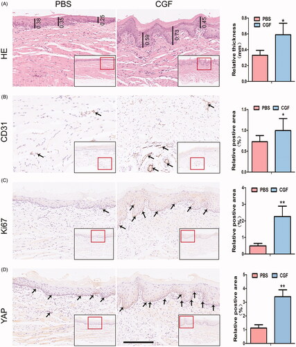 Figure 6. YAP promotes gingival regeneration in CGF microenvironment in vivo. (A) Representative images of HE staining showed that the thickness in the CGF group was higher than that in the PBS group. Scale bar: 100 μm. (B, C, D): Representative images of immunohistochemistry staining indicated that the expression level of angiogenic marker (CD31), proliferation marker (Ki67), and transcription coactivator (YAP) in the CGF group was much higher as compared to the PBS group. Scale bar: 100 μm. *p < .05; **p < .01.